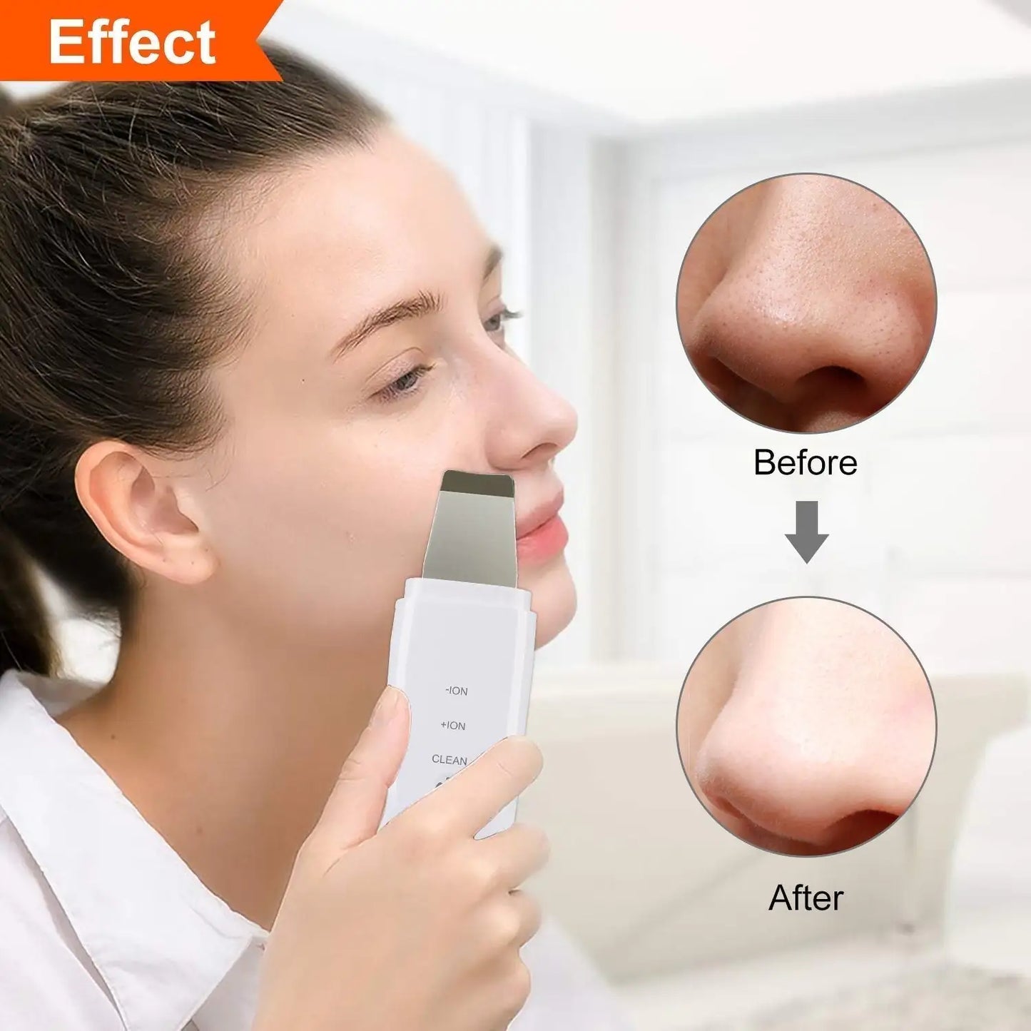 Ultrasonic Skin Scrubber